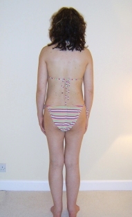 lose weight after pregnancy - 14 days after having my baby, back view